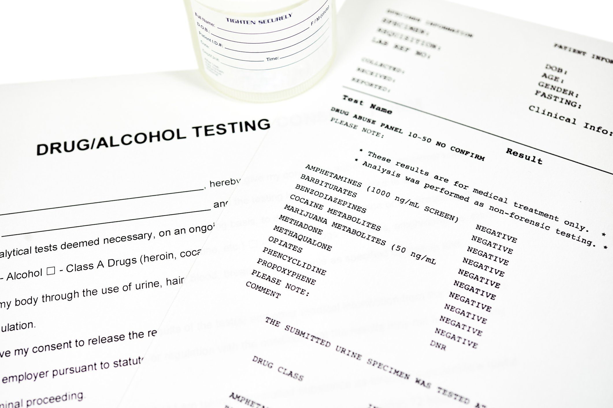 Drug and alcohol testing consent form with results from a drug abuse panel lab report with an urine specimen container