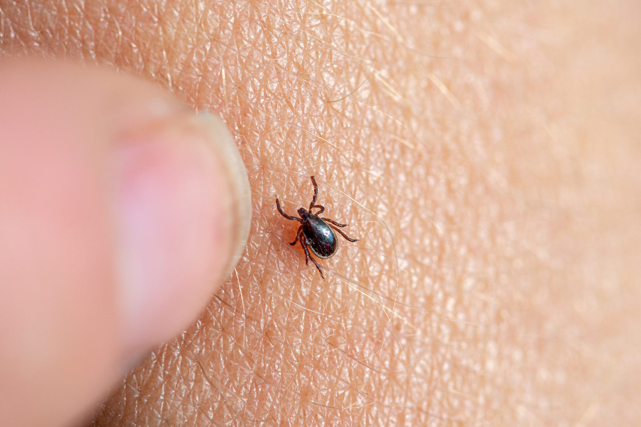 tick on person's arm